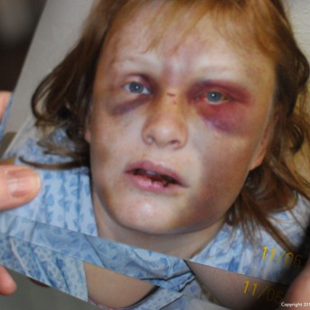 Still from Private Violence. A person is holding a stack of photographs of a victim whose face has been beaten–black eyes, bruises, and scratches.