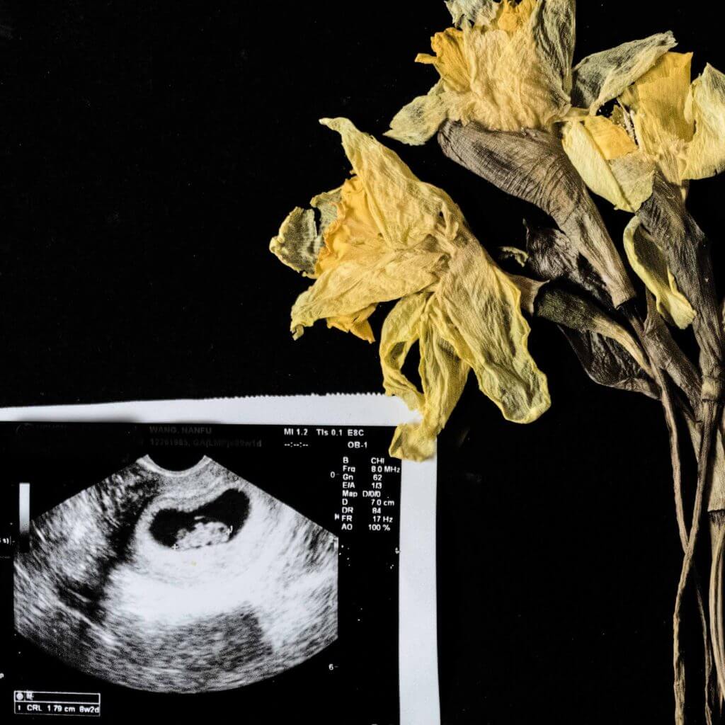 Nanfu Wang Lynn Zhang Born In China 2017 Accelerator Lab