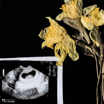 Nanfu Wang Lynn Zhang Born In China 2017 Accelerator Lab