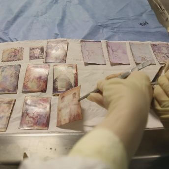 Still from Number 387. Three gloved hands are examining photos on a medical table.