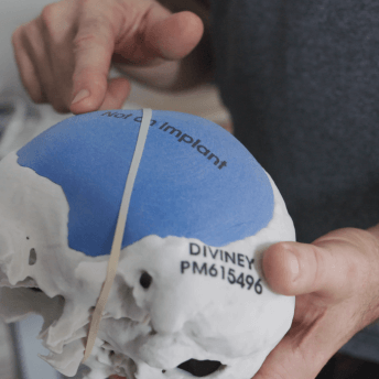 A person is holding a round prosthetic colored blue and white with a rubber band wrapped around the center. The prosthetic has "not an implant" written across the center.