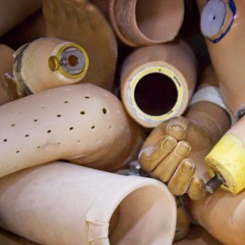 The prothesis fabric in Rojava which produces prothesis legs and arms for whose body part is amputated during the war.